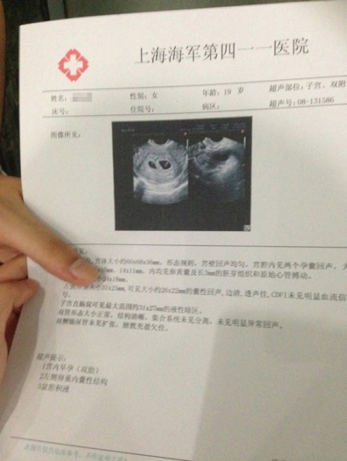 19岁少女做人流前上网晒图：舍不得这对双胞胎